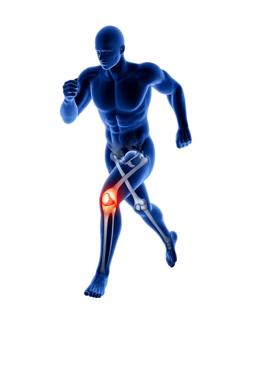 Medical illustration of a runner with visible knee joint highlighting orthopaedic care